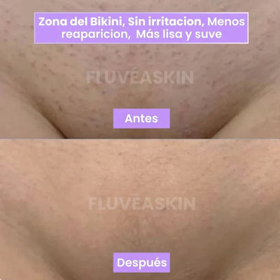 Lunéa™ - Vello fino y menos visible con Raiz de Cyperus Rotundus