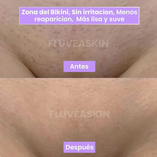 Lunéa™ - Vello fino y menos visible con Raiz de Cyperus Rotundus