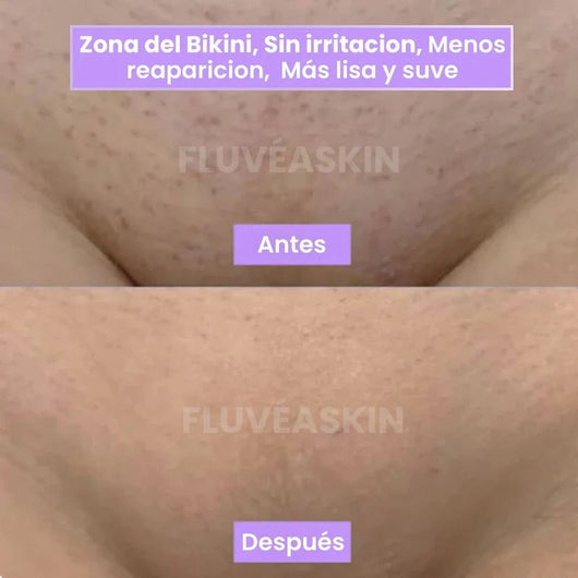 Lunéa™ - Vello fino y menos visible con Raiz de Cyperus Rotundus